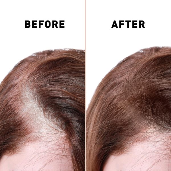 Anti Hair Loss Serum 2 In 1 Natural Hair Fall Serum Ginger And Tocopherol Hair Growth Essence Oil Hair Care Serum | Hair Loss Treatment For Men & Women |