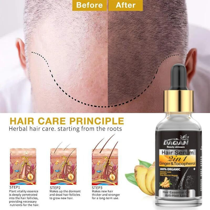 natural hair serum for hair loss
herbal hair growth oil
hair fall control serum
ginger hair serum
anti hair loss serum





